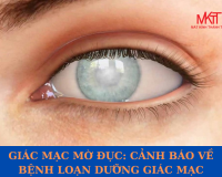 GIÁC MẠC MỜ ĐỤC: CẢNH BÁO VỀ BỆNH LOẠN DƯỠNG GIÁC MẠC